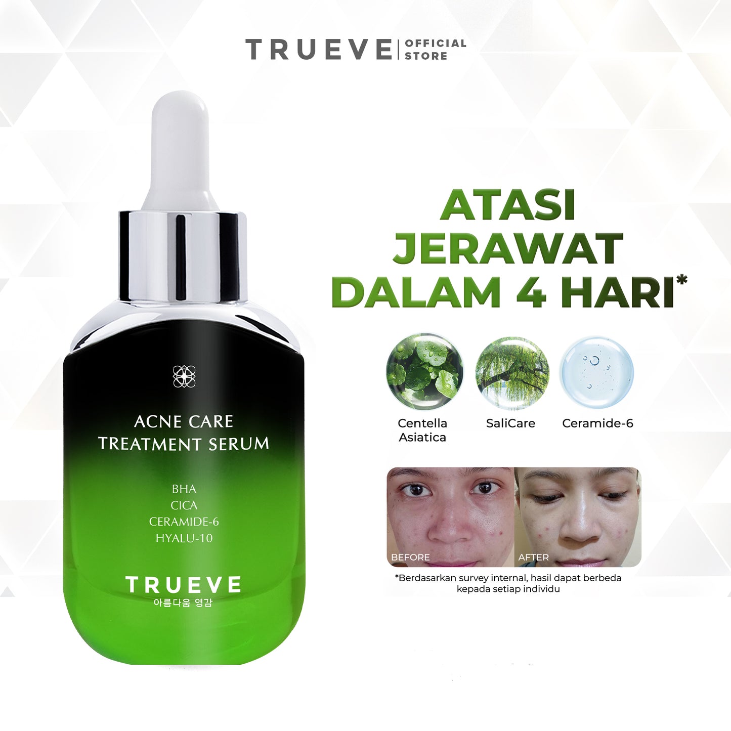 Trueve Acne Care Treatment Serum